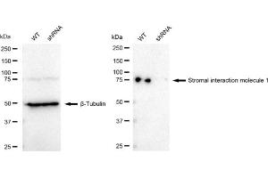 Western blotting analysis using Stromal interaction molecule 1 antibody (ABIN7800445).