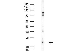 anti-ER Membrane Protein Complex Subunit 4 (EMC4) antibody