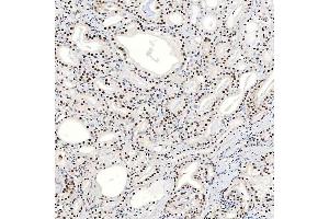 IHC analysis of SNRNP40 using anti-SNRNP40 antibody (ABIN7601719).