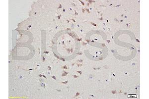 Formalin-fixed and paraffin embedded rat brain labeled with Rabbit Anti-CD45/B220 Polyclonal Antibody, Unconjugated (ABIN669606) at 1:200 followed by conjugation to the secondary antibody and DAB staining.