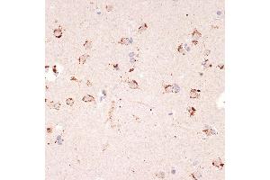 Immunohistochemistry of paraffin-embedded human brain using Ephrin  Rabbit mAb (ABIN7266976) at dilution of 1:100 (40x lens). (Ephrin A1 antibody)