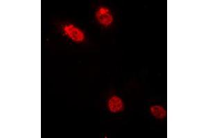 Immunofluorescent analysis of c-Myb staining in HeLa cells. (MYB antibody  (N-Term))