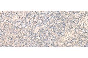 Immunohistochemistry of paraffin-embedded Human tonsil tissue using PITPNB Polyclonal Antibody at dilution of 1:25(x200)
