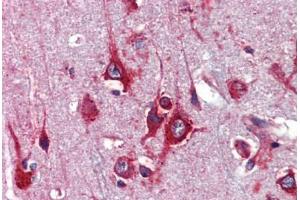 Human Brain, Cortex (formalin-fixed, paraffin-embedded) stained with TFAP2C antibody ABIN462192 followed by biotinylated goat anti-rabbit IgG secondary antibody ABIN481713, alkaline phosphatase-streptavidin and chromogen. (TFAP2C antibody  (AA 252-301))