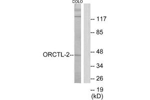Western Blotting (WB) image for anti-Solute Carrier Family 22 Member 18 (SLC22A18) (C-Term) antibody (ABIN1849893) (ORCTL-2/SLC22A18 antibody  (C-Term))