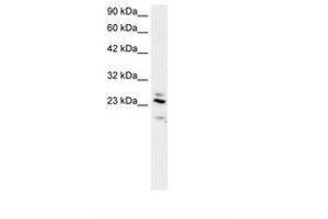 Image no. 2 for anti-Regulator of G-Protein Signaling 20 (RGS20) (AA 127-176) antibody (ABIN202110) (RGS20 antibody  (AA 127-176))