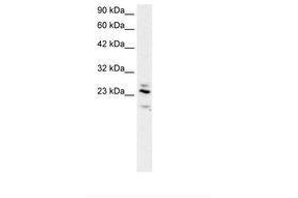RGS20 anticorps  (AA 127-176)