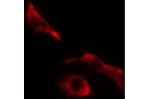ABIN6274623 staining HeLa cells by IF/ICC. (COL5A1 antibody  (Internal Region))