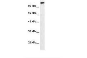 Image no. 1 for anti-GLI Family Zinc Finger 2 (GLI2) (AA 600-649) antibody (ABIN202982) (GLI2 antibody  (AA 600-649))