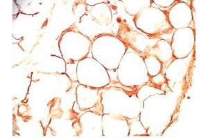Rat visceral fat tissue was stained by Rabbit Anti-sFRP-2 (25-50) (Human) Antiserum (SFRP2 antibody  (AA 25-50))