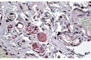 (ABIN185409) (3. (NPY5R antibody  (Internal Region))