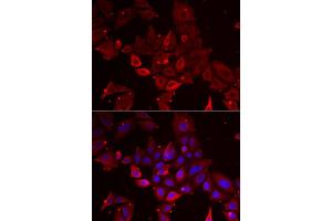 Immunofluorescence analysis of U2OS cell using MYOT antibody.