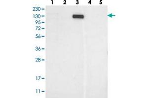 Western blot analysis of Lane 1: RT-4, Lane 2: U-251 MG, Lane 3: Human Plasma, Lane 4: Liver, Lane 5: Tonsil with MKL1 polyclonal antibody  at 1:250-1:500 dilution.