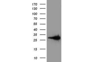 HEK293T cells were transfected with the pCMV6-ENTRY control (Left lane) or pCMV6-ENTRY LXN (Right lane) cDNA for 48 hrs and lysed. (Latexin antibody)