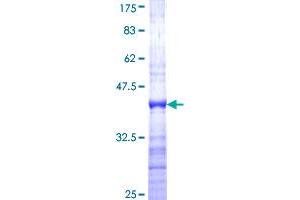 FOXG1 Protein (AA 183-291) (GST tag)