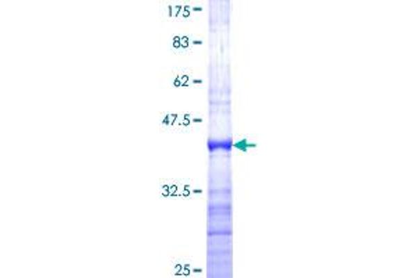 FOXG1 Protein (AA 183-291) (GST tag)