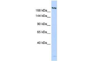 Western Blot showing JMJD3 antibody used at a concentration of 1-2 ug/ml to detect its target protein. (Kdm6b antibody  (N-Term))