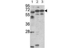 Western blot analysis of Fascin-3 antibody and 1) MDA-MB231, 2) NCI-H460 cell line and 3) mouse testis tissue lysate. (Fascin 3 antibody  (AA 1-30))