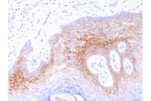 Formalin-fixed, paraffin-embedded human Skin stained with Desmocollin-2/3 Mouse Monoclonal Antibody (7G6). (Desmocollin 2 antibody  (Extracellular Domain))
