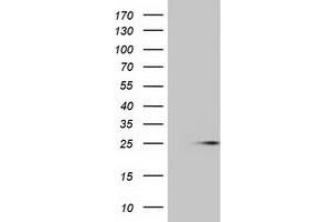 HEK293T cells were transfected with the pCMV6-ENTRY control (Left lane) or pCMV6-ENTRY MOBKL1A (Right lane) cDNA for 48 hrs and lysed. (MOBKL1A antibody)