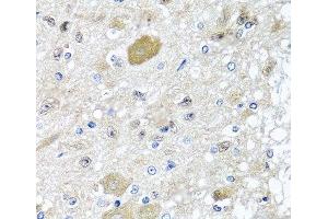 Immunohistochemistry of paraffin-embedded Rat brain using CST1 Polyclonal Antibody at dilution of 1:100 (40x lens). (CST1 antibody)