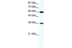 Human Jurkat; WB Suggested Anti-FOXF1 Antibody Titration: 1. (FOXF1 antibody  (N-Term))