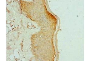 Immunohistochemistry of paraffin-embedded human skin tissue using ABIN7157648 at dilution of 1:100 (KIF2B antibody  (AA 544-673))