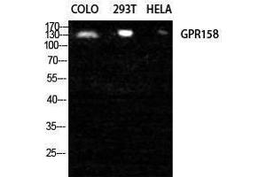 Western Blotting (WB) image for anti-G Protein-Coupled Receptor 158 (GPR158) (N-Term) antibody (ABIN3184869) (GPR158 antibody  (N-Term))