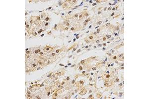 Immunohistochemistry (IHC) image for anti-Discs, Large (Drosophila) Homolog-Associated Protein 5 (DLGAP5) (AA 547-846) antibody (ABIN3023190)