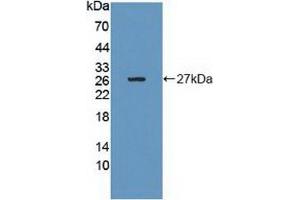 Detection of Recombinant Grb10, Human using Polyclonal Antibody to Growth Factor Receptor Bound Protein 10 (Grb10) (GRB10 antibody  (AA 392-594))