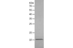 Western Blotting (WB) image for Chemokine (C-X-C Motif) Ligand 12 (CXCL12) (AA 22-89) protein (His tag) (ABIN7122325) (CXCL12 Protein (AA 22-89) (His tag))