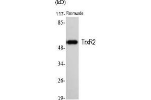Western Blot analysis of various cells using TrxR2 Polyclonal Antibody. (TXNRD2 antibody  (AA 440-520))