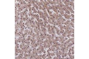 Immunohistochemical staining of human liver with SLC38A7 polyclonal antibody  shows moderate cytoplasmic and nuclear membranous positivity in hepatocytes at 1:200-1:500 dilution.