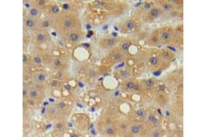Used in DAB staining on fromalin fixed paraffin-embedded liver tissue (IL17 Receptor B antibody  (AA 61-200))