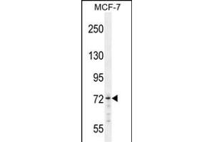 MED25 Antibody (N-term) ( (ABIN654162 and ABIN2844026) western blot analysis in MCF-7 cell line lysates (35 μg/lane). (MED25 antibody  (AA 112-140))