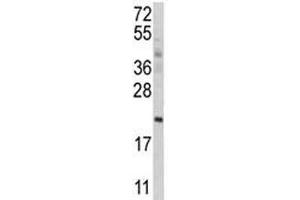 Western blot analysis of ATG12 antibody and MCF-7 lysate. (ATG12 antibody  (AA 1-50))