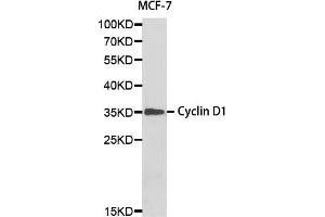 Western blot analysis of MCF-7 cell lysate using CCND1 antibody. (Cyclin D1 antibody)