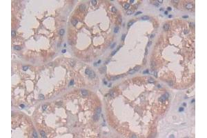 DAB staining on IHC-P; Samples: Human Kidney Tissue (IL28A antibody  (AA 26-200))