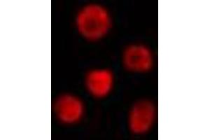 ABIN6274314 staining Hela cells by IF/ICC. (CREM antibody  (Internal Region))