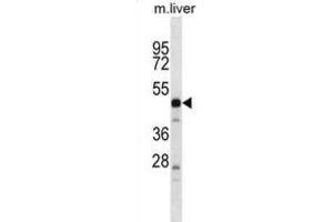 Western Blotting (WB) image for anti-Protease, serine, 16 (Thymus) (PRSS16) antibody (ABIN2998848)