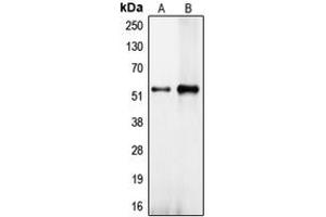 Western blot analysis of CEP57 expression in NT2D1 (A), HeLa (B) whole cell lysates. (CEP57 antibody  (Center))