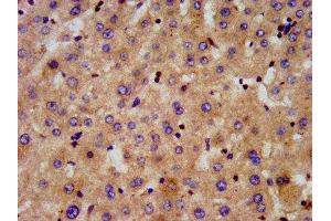 IHC image of ABIN7143948 diluted at 1:300 and staining in paraffin-embedded human liver tissue performed on a Leica BondTM system. (Chromosome 6 Open Reading Frame 134 (C6orf134) (AA 194-238) antibody)