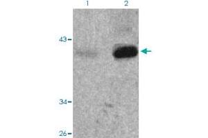 Western blot analysis of Lane 1: 293 cells, Lane 2: TNF treated 293 cells with Nfkbie (phospho S22) polyclonal antibody  at 1:500-1:1000 dilution.