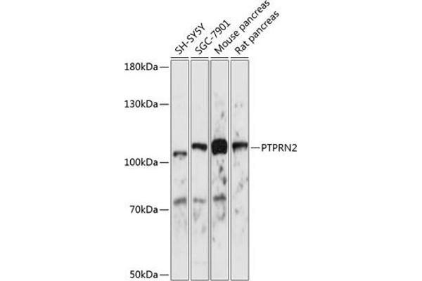 PTPRN2 antibody  (AA 22-242)