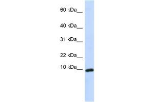 WB Suggested Anti-CXCL9 Antibody Titration:  0.