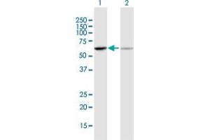 Western Blot analysis of UGT1A6 expression in transfected 293T cell line by UGT1A6 MaxPab polyclonal antibody. (UGT1A6 antibody  (AA 1-532))