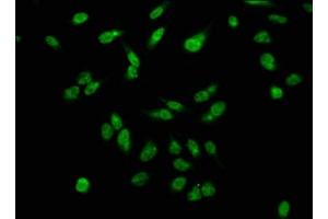 Immunofluorescence staining of Hela cells with ABIN7139615 at 1:2. (H2AFX antibody  (pSer139))