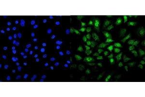 IF analysis of Mesp2 using anti-Mesp2 antibody (ABIN7599353). (Mesp2 antibody  (AA 1-397))