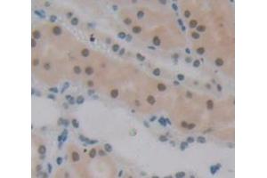 Figure. (Polybromo 1 antibody  (AA 957-1086))