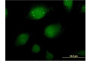 Immunofluorescence of monoclonal antibody to ING2 on HeLa cell.